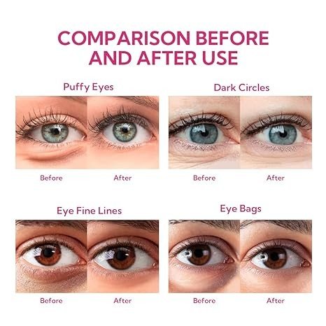 BREYLEE Rose Eye Mask– 60 Pcs, Under Eye Patches,Eye Patches For Puffy Eyes,Hydrates, Improves And Firms The Eye Area, Suitable For Both Women And Men.