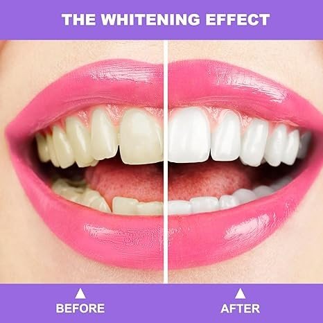 Purple Toothpaste for Teeth Whitening,Teeth Whitening Booster,Tooth Stain Removal,Teeth Whitener,Purple Whitening Toothpaste