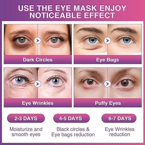 BESNEL Eye Gels Pads 32 Pairs，Under Eye Patches Helps Reduce Puffy Eyes，Wrinkles and Dark Circles，Eye Mask with Collagen Protein，Pearl Extract and Hyaluronic Acid，Beauty & Personal Care